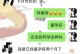 分手后复合成功的挽回前男友秘诀（以真情和坚持，让爱在复合中更加美好）